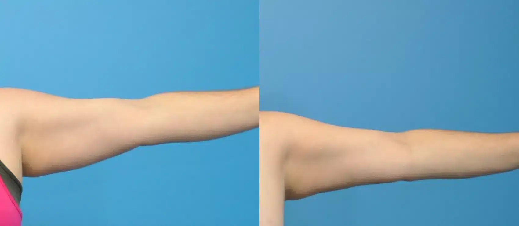 Before and After Image: Case #129 - front