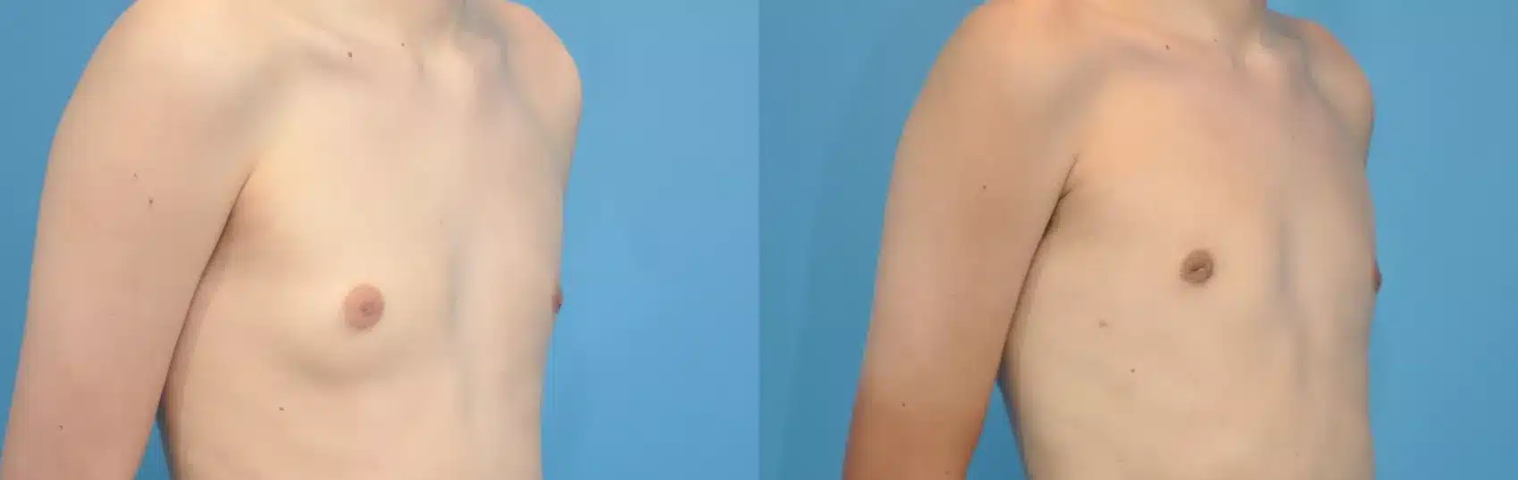 Before and After Image: Case #130 - right-front-oblique