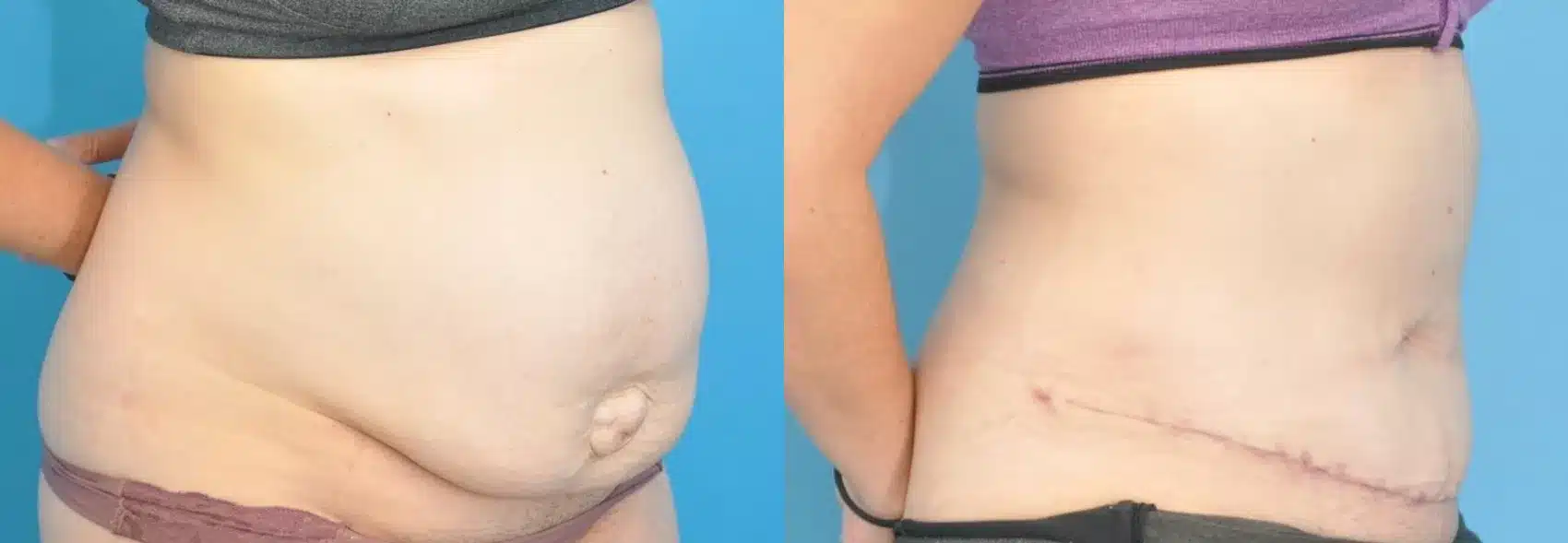 Before and After Image: Case #189 - right-front-oblique
