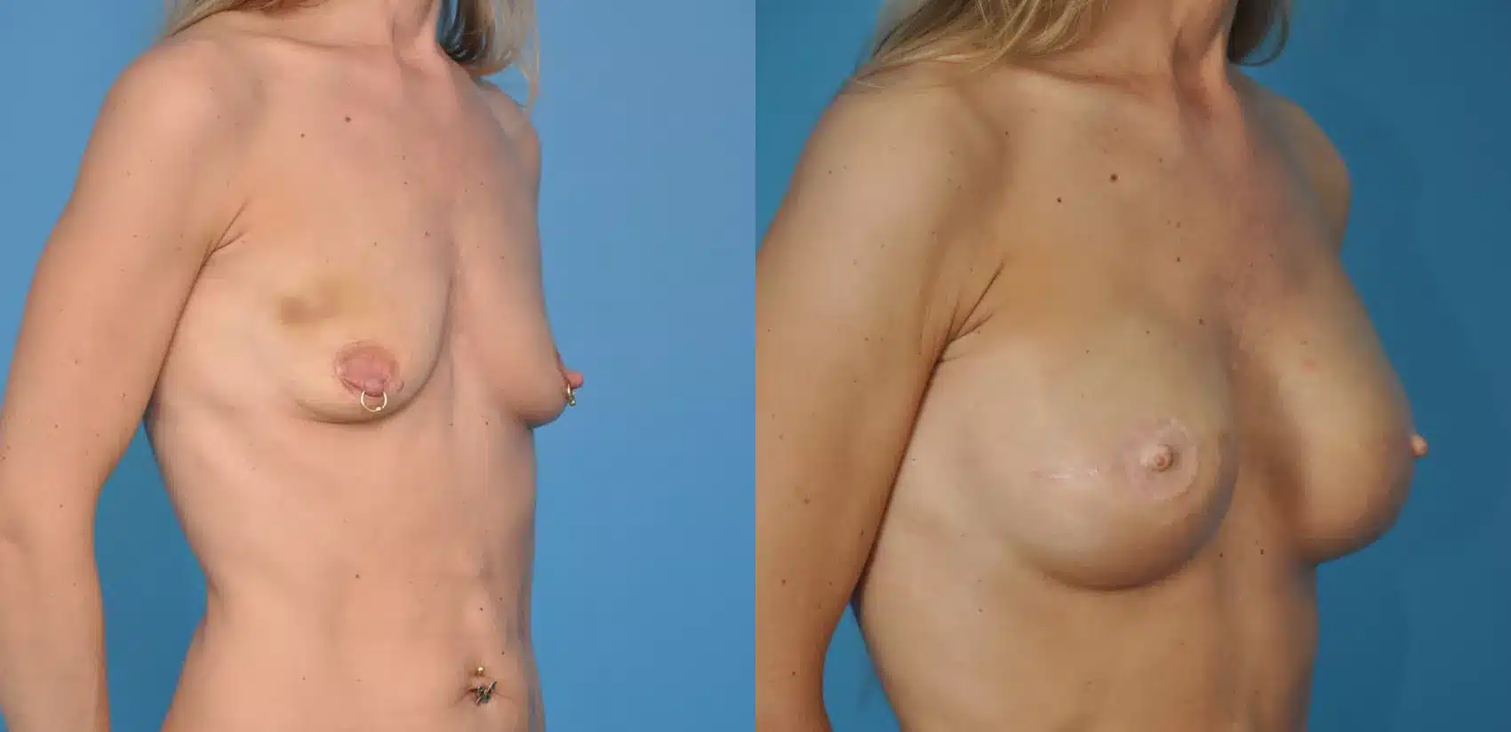 Before and After Image: Case #19 - right-front-oblique