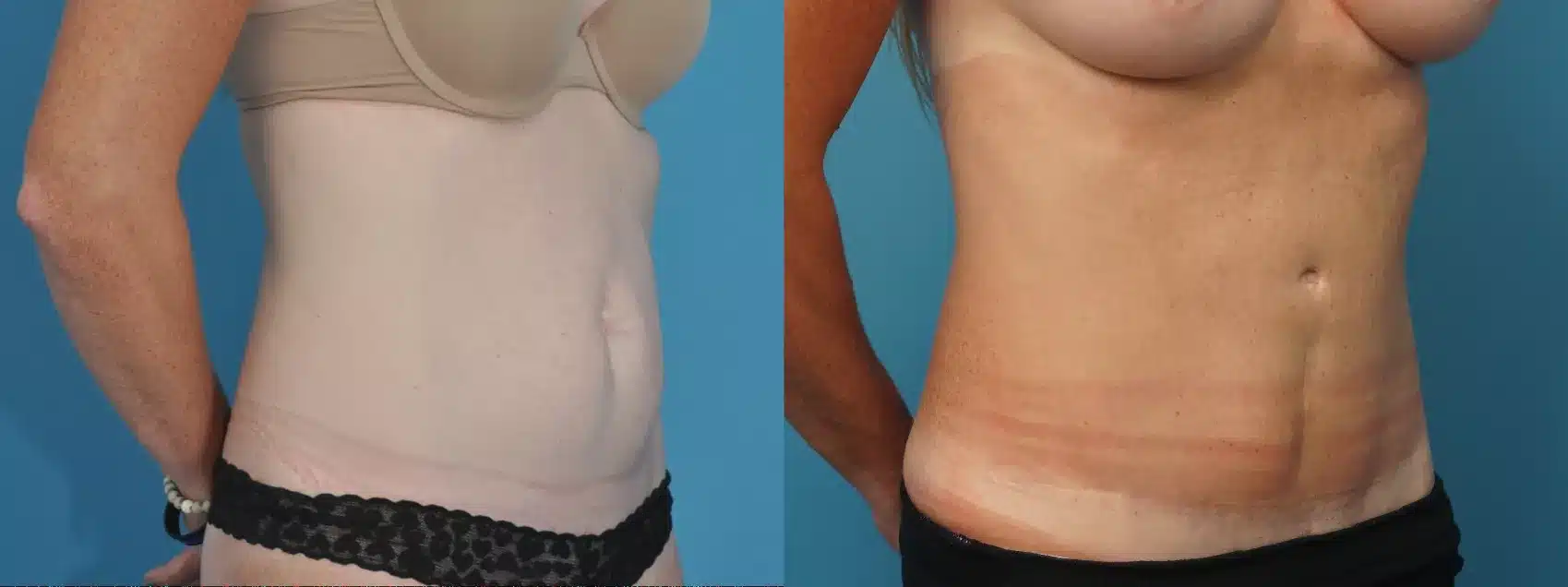Before and After Image: Case #192 - right-front-oblique