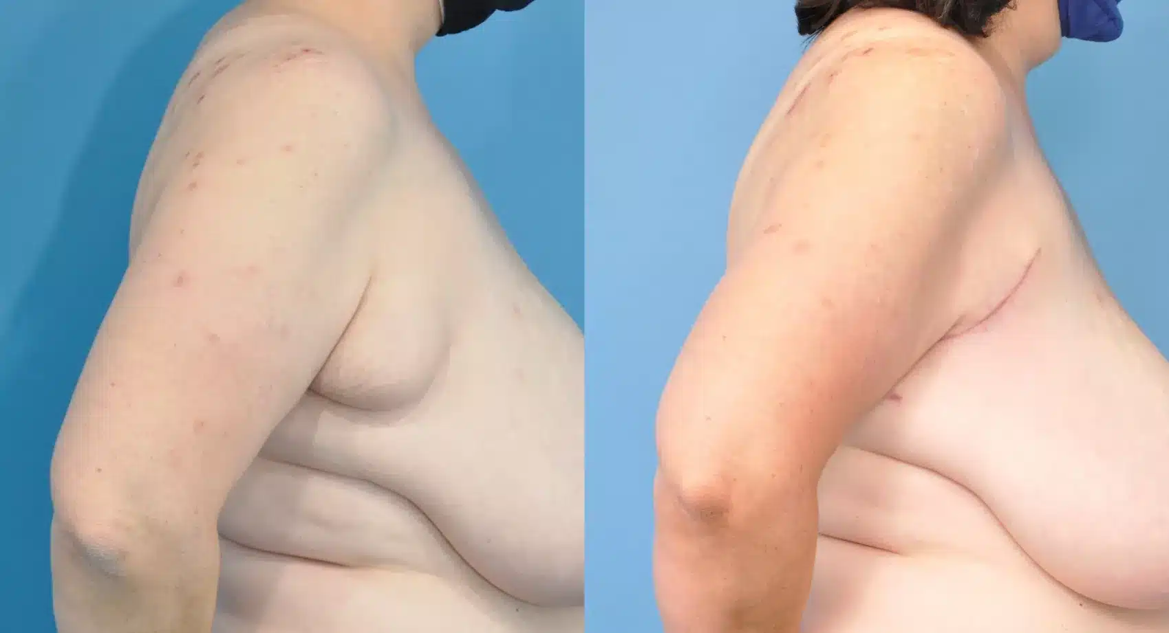 Before and After Image: Case #224