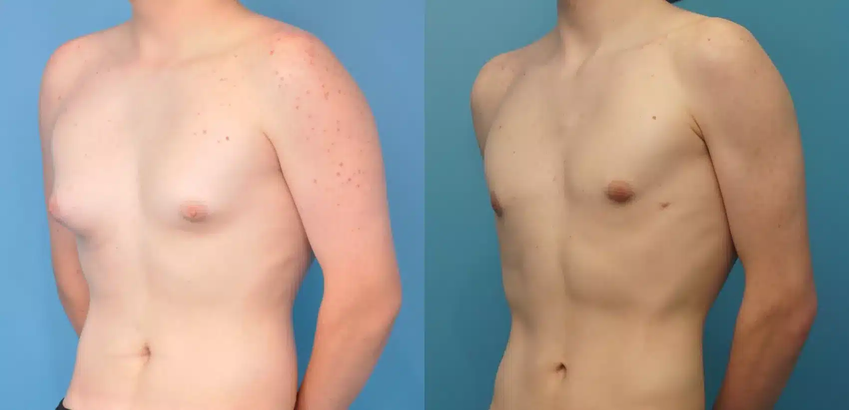 Before and After Image: Case #272 - left-front-oblique
