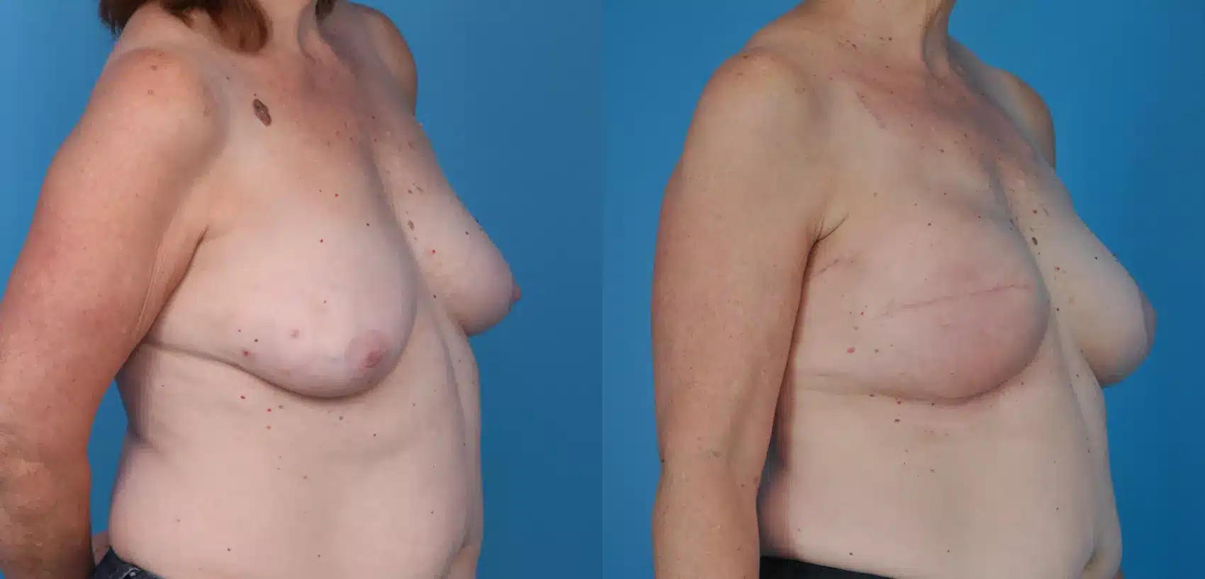 Before and After Image: Case #28 - right-front-oblique