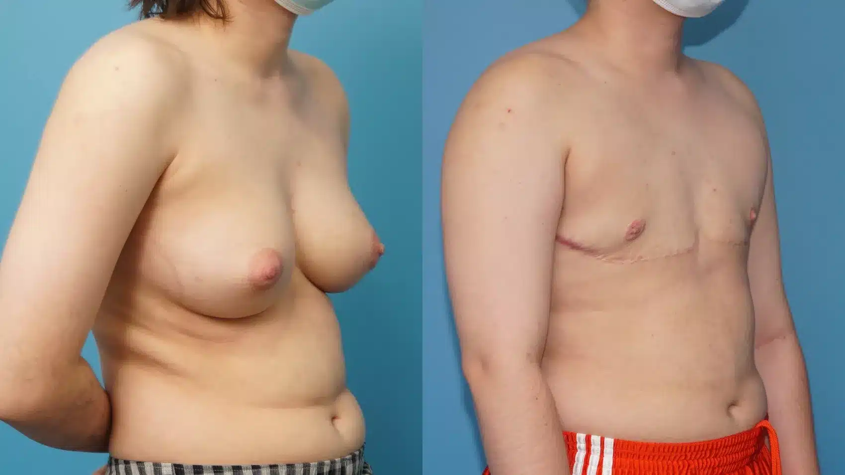 Before and After Image: Case #397 - right-front-oblique
