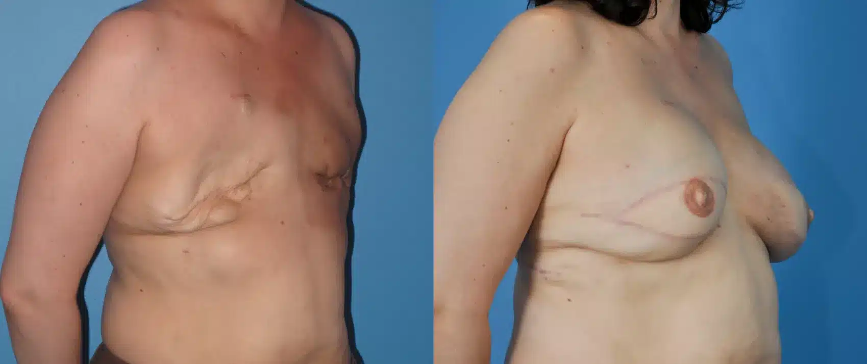 Before and After Image: Case #42 - right-front-oblique