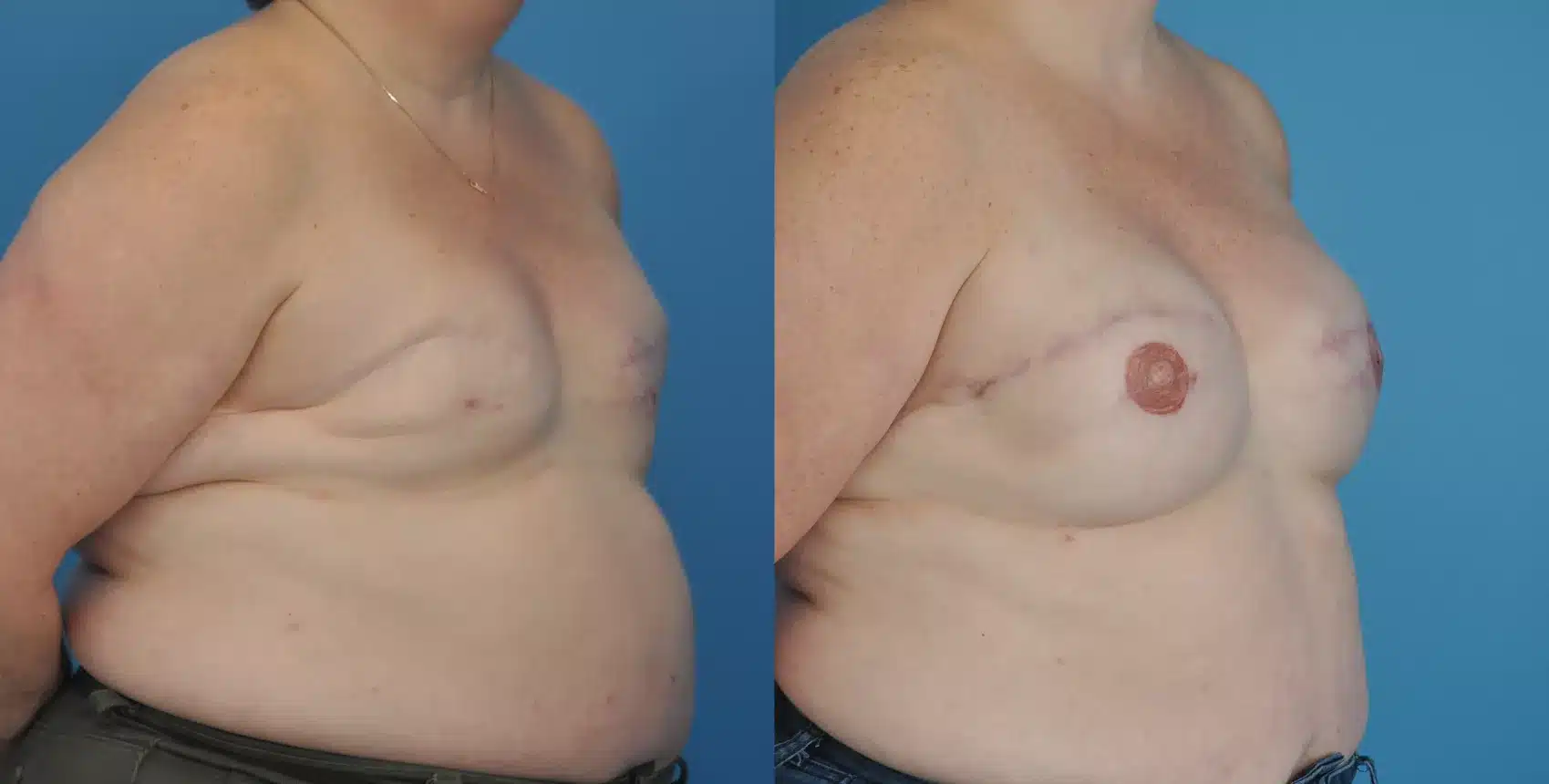 Before and After Image: Case #50 - right-front-oblique