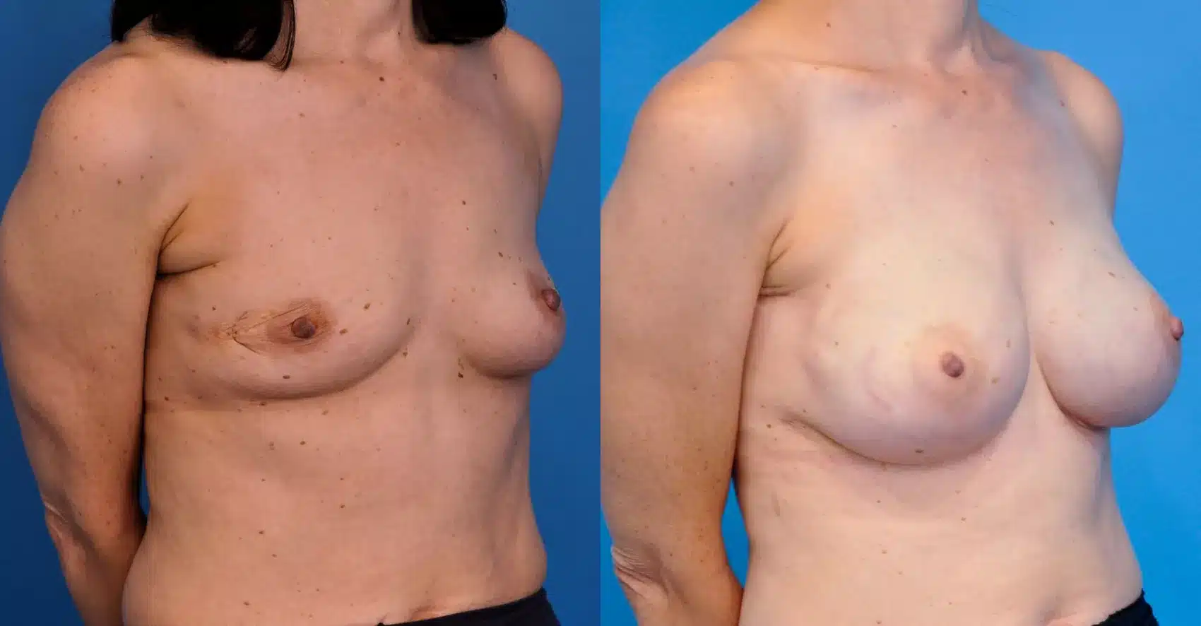 Before and After Image: Case #9 - right-front-oblique